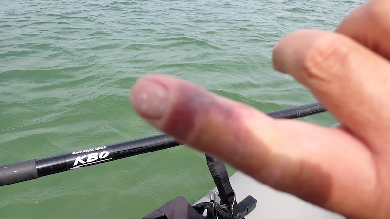 240527 hans v klinken haevet finger